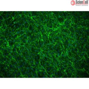 Sciencell Human Primary Annulus Fibrosus Cells