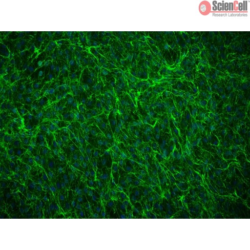 Sciencell Human Primary Annulus Fibrosus Cells