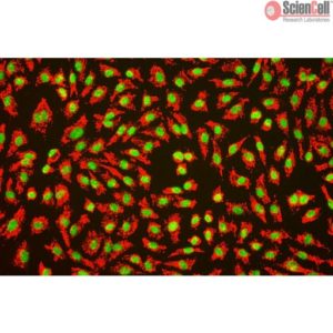 Sciencell Human Primary Endothelial Cells