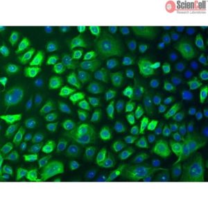 Sciencell Human Primary Keratinocytes Cells