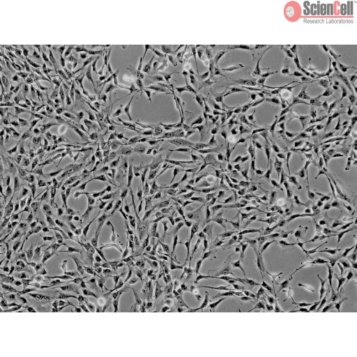 Sciencell Human Primary Mesenchymal Stem Cells - Image 4