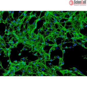 Sciencell Human Primary Osteoblasts Cell