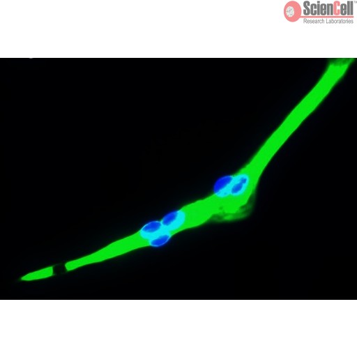 Sciencell Human Primary Skeletal Muscle Cells