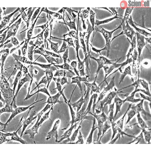 Sciencell Human Primary Skeletal Muscle Cells - Image 2