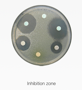 Inhibition zone measurement
